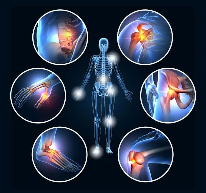 Illustration orthopédique